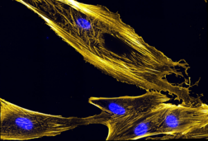 Myoblasts fibers (yellow) -- precursor to muscle cells -- and nuclei in blue.