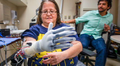 Karen Sussex, an upper-limb amputee from Jackson, Mich., operates a Touch Bionics I-LIMB prosthetic hand