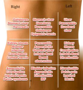 A photo of a person's back with a grid and text on top that describe locations and types of pain. 