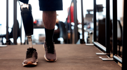 A study participant tests the Össur Power Knee in the Locomotor Control Systems Laboratory at the University of Michigan. This is a close-up of two legs from the knee down; one leg is a robotic prosthesis. The study results showed that the robotic prosthetic leg offered benefits for both high and low mobility prosthesis users. (Image: Brenda Ahearn, Michigan Engineering.)