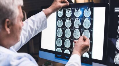 Physician examines film that shows concussion impact in brains.