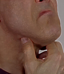 Caucasian man clutches skin under the chin.