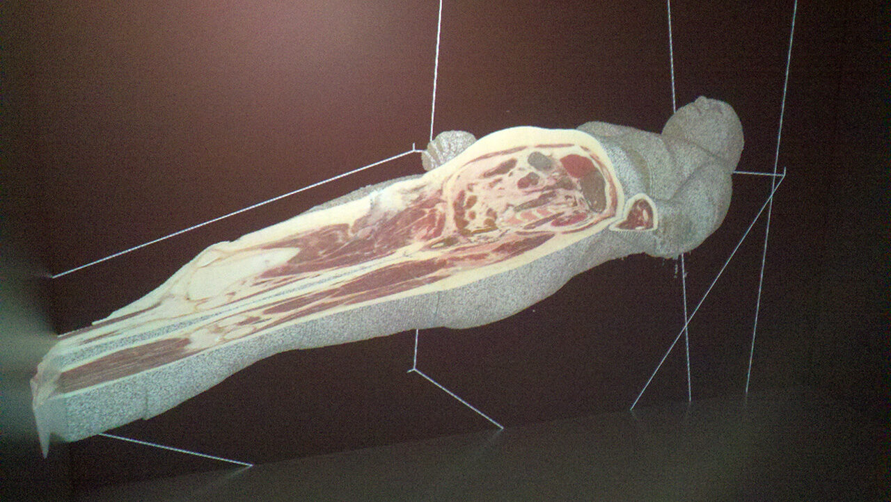 3-D virtual cadaver, large.