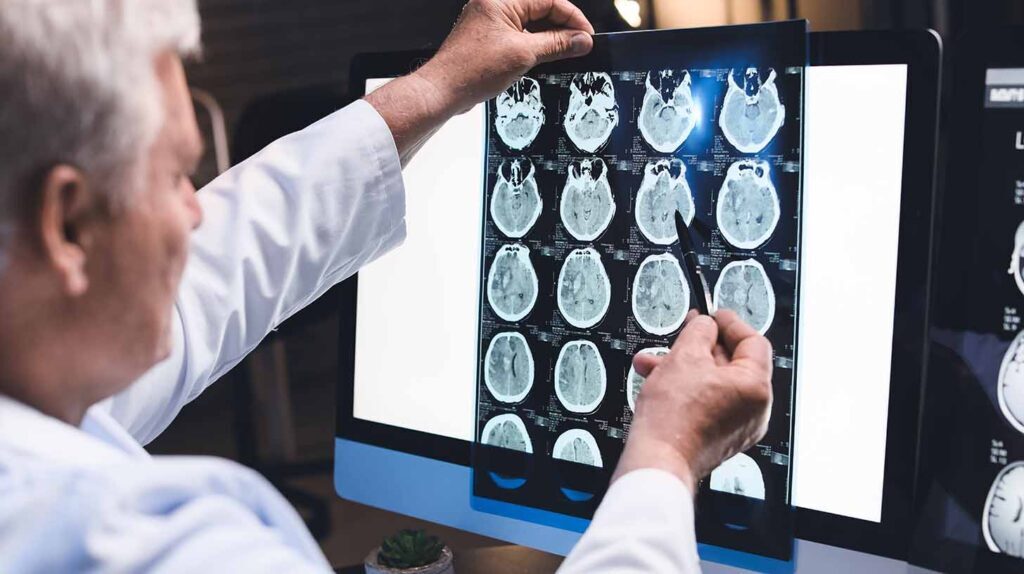 Physician examines film that shows concussion impact in brains.